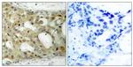 Phospho-Androgen Receptor (Ser650) Antibody in Immunohistochemistry (Paraffin) (IHC (P))