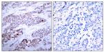 Phospho-ATF4 (Ser245) Antibody in Immunohistochemistry (Paraffin) (IHC (P))