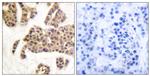 Phospho-BAD (Ser91, Ser128) Antibody in Immunohistochemistry (Paraffin) (IHC (P))