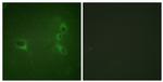 Phospho-BCR (Tyr360) Antibody in Immunocytochemistry (ICC/IF)