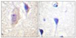 Phospho-BCR (Tyr360) Antibody in Immunohistochemistry (Paraffin) (IHC (P))