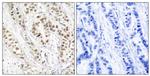 Phospho-BRCA1 (Ser1524) Antibody in Immunohistochemistry (Paraffin) (IHC (P))