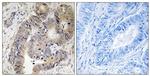 Phospho-CAD (Thr456) Antibody in Immunohistochemistry (Paraffin) (IHC (P))