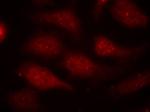 Phospho-CDK6 (Tyr24) Antibody in Immunocytochemistry (ICC/IF)