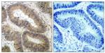 Phospho-IKK alpha (Thr23) Antibody in Immunohistochemistry (Paraffin) (IHC (P))