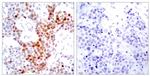 Phospho-ATF2 (Thr51, Thr69) Antibody in Immunohistochemistry (Paraffin) (IHC (P))