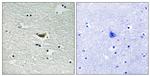 Phospho-CK1 alpha (Tyr294) Antibody in Immunohistochemistry (Paraffin) (IHC (P))