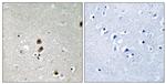 Phospho-CtBP1 (Ser422) Antibody in Immunohistochemistry (Paraffin) (IHC (P))