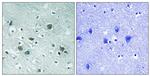 Phospho-CRMP2 (Thr509) Antibody in Immunohistochemistry (Paraffin) (IHC (P))