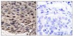 Phospho-4EBP1 (Thr37) Antibody in Immunohistochemistry (Paraffin) (IHC (P))