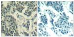 Phospho-ErbB3 (Tyr1328) Antibody in Immunohistochemistry (Paraffin) (IHC (P))