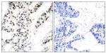 Phospho-Estrogen Receptor alpha (Ser106) Antibody in Immunohistochemistry (Paraffin) (IHC (P))