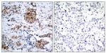 Phospho-Estrogen Receptor alpha (Ser167) Antibody in Immunohistochemistry (Paraffin) (IHC (P))