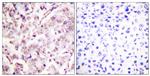 Phospho-ETS1 (Thr38) Antibody in Immunohistochemistry (Paraffin) (IHC (P))