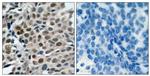 Phospho-FOXO3A (Ser253) Antibody in Immunohistochemistry (Paraffin) (IHC (P))