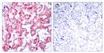 Phospho-GATA1 (Ser142) Antibody in Immunohistochemistry (Paraffin) (IHC (P))