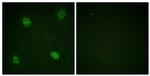 Phospho-hnRNP D (Ser83) Antibody in Immunocytochemistry (ICC/IF)