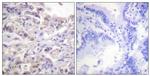 Phospho-hnRNP D (Ser83) Antibody in Immunohistochemistry (Paraffin) (IHC (P))