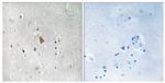 Phospho-IGF1R beta (Tyr1346) Antibody in Immunohistochemistry (Paraffin) (IHC (P))