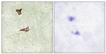 Phospho-IGF2R (Ser2409) Antibody in Immunohistochemistry (Paraffin) (IHC (P))