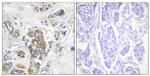 Phospho-CD104 (Tyr1510) Antibody in Immunohistochemistry (Paraffin) (IHC (P))