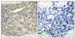 Phospho-LIMK1 (Thr508) Antibody in Immunohistochemistry (Paraffin) (IHC (P))