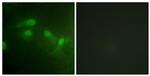 Phospho-MDM2 (Ser186, Ser188) Antibody in Immunocytochemistry (ICC/IF)