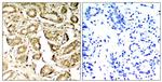 Phospho-MEF2A (Ser408) Antibody in Immunohistochemistry (Paraffin) (IHC (P))