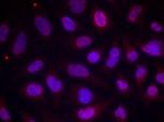 Phospho-MEF2A (Thr312) Antibody in Immunocytochemistry (ICC/IF)