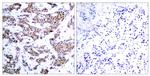 Phospho-MEF2A (Thr312) Antibody in Immunohistochemistry (Paraffin) (IHC (P))