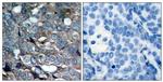 Phospho-ASK1 (Ser83) Antibody in Immunohistochemistry (Paraffin) (IHC (P))