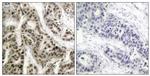 Phospho-NFkB p105/p50 (Ser337) Antibody in Immunohistochemistry (Paraffin) (IHC (P))