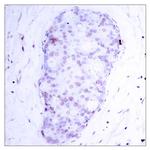 Phospho-NFkB p105 (Ser907) Antibody in Immunohistochemistry (Paraffin) (IHC (P))