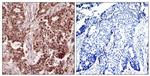 Phospho-NFkB p105 (Ser927) Antibody in Immunohistochemistry (Paraffin) (IHC (P))