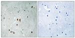 Phospho-CNOT2 (Ser101) Antibody in Immunohistochemistry (Paraffin) (IHC (P))