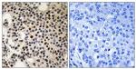 Phospho-PAK2 (Ser197) Antibody in Immunohistochemistry (Paraffin) (IHC (P))