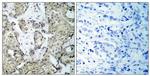 Phospho-MEK3 (Ser189) Antibody in Immunohistochemistry (Paraffin) (IHC (P))