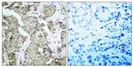 Phospho-MEK6 (Ser207) Antibody in Immunohistochemistry (Paraffin) (IHC (P))