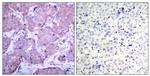 Phospho-PTEN (Ser380) Antibody in Immunohistochemistry (Paraffin) (IHC (P))