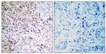 Phospho-Rb (Ser795) Antibody in Immunohistochemistry (Paraffin) (IHC (P))