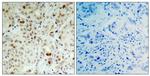 Phospho-Rb (Ser807) Antibody in Immunohistochemistry (Paraffin) (IHC (P))