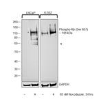 Phospho-Rb (Ser807) Antibody in Western Blot (WB)