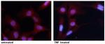 Phospho-NFkB p65 (Ser276) Antibody in Immunocytochemistry (ICC/IF)