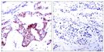 Phospho-NFkB p65 (Ser276) Antibody in Immunohistochemistry (Paraffin) (IHC (P))