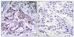 Phospho-NFkB p65 (Thr435) Antibody in Immunohistochemistry (Paraffin) (IHC (P))