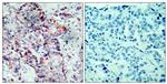 Phospho-MAP2K4 (Ser80) Antibody in Immunohistochemistry (Paraffin) (IHC (P))