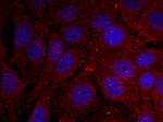 Phospho-alpha Synuclein (Tyr136) Antibody in Immunocytochemistry (ICC/IF)