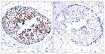 Phospho-STAT5 alpha (Ser780) Antibody in Immunohistochemistry (Paraffin) (IHC (P))