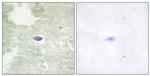 Phospho-TGFBR2 (Ser225, Ser250) Antibody in Immunohistochemistry (Paraffin) (IHC (P))