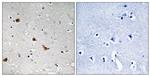 Phospho-IKK gamma (Ser376) Antibody in Immunohistochemistry (Paraffin) (IHC (P))